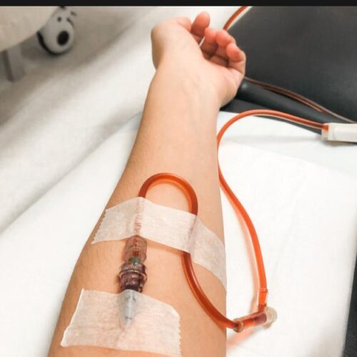 iron-infusion Iron Infusions