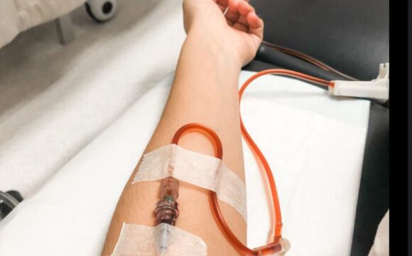 Iron Infusions