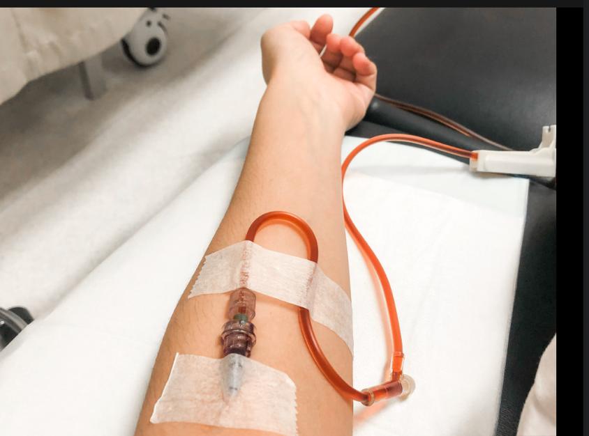 Do You Feel Good After Iron Infusion